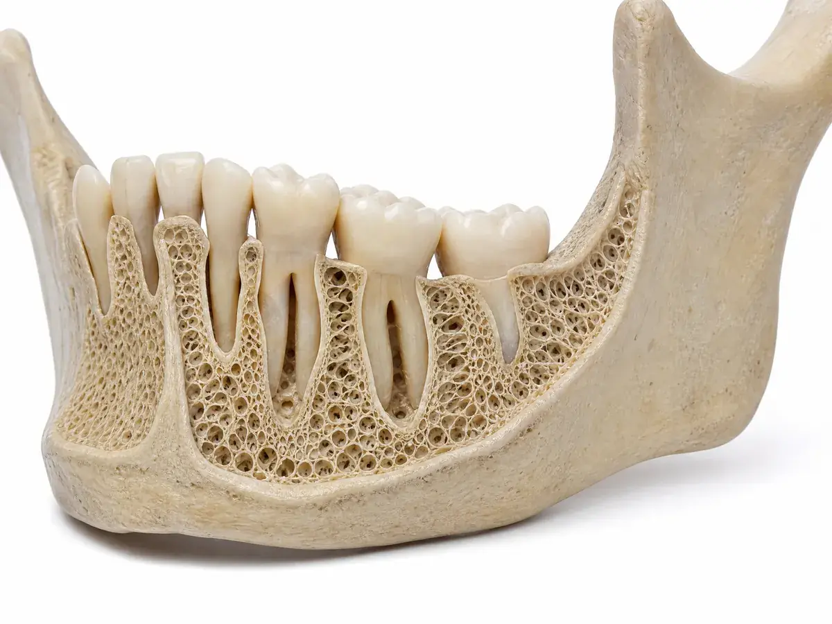 Bone Preservation – Zahnarztpraxis Spring Berlin-Tegel